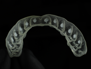 Teeth whitening tray