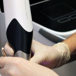 Teeth Scanning Cerec