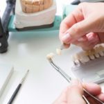 Dental Veneers in London - Bow lane Dental Group