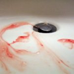 What causes Bleeding Gums