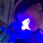 Mouth Cancer Screening - Bow lane Dental Group