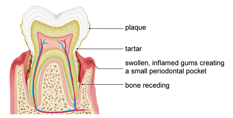Gum treatments London Gum treatments London