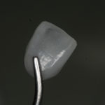 dental veneers - Bow Lane Dental Group